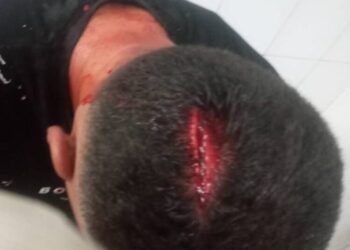 اجرائیات شهرداری مسجد سلیمان باعث جراحت شدید یکی از کارکنان شد