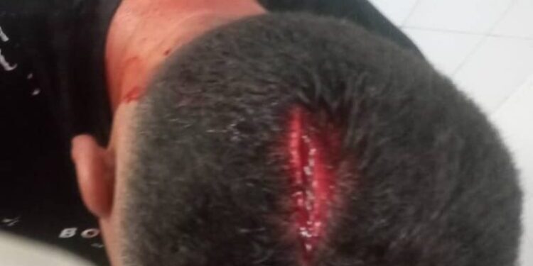 اجرائیات شهرداری مسجد سلیمان باعث جراحت شدید یکی از کارکنان شد